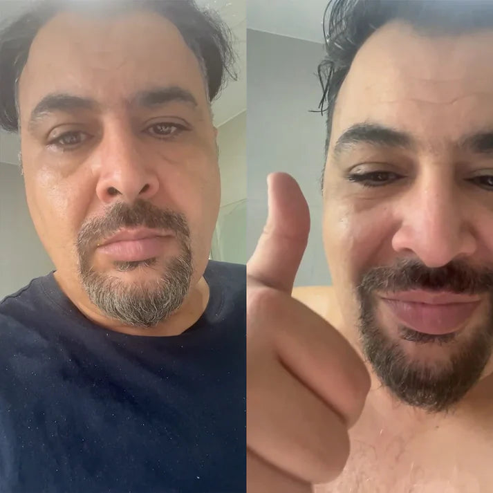 شامبو ديسار لتغطية الشيب بخلاصة الجرجير